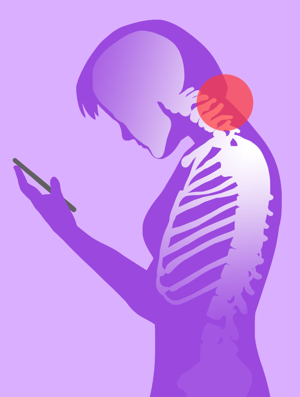 Smartphone generation suffers neck problems
