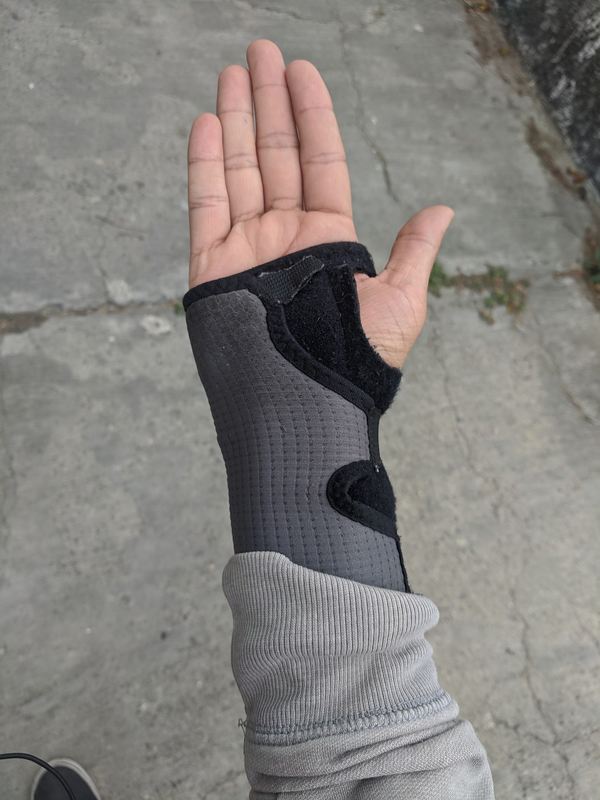 Reducing the pain, increasing function with wrist arthritis