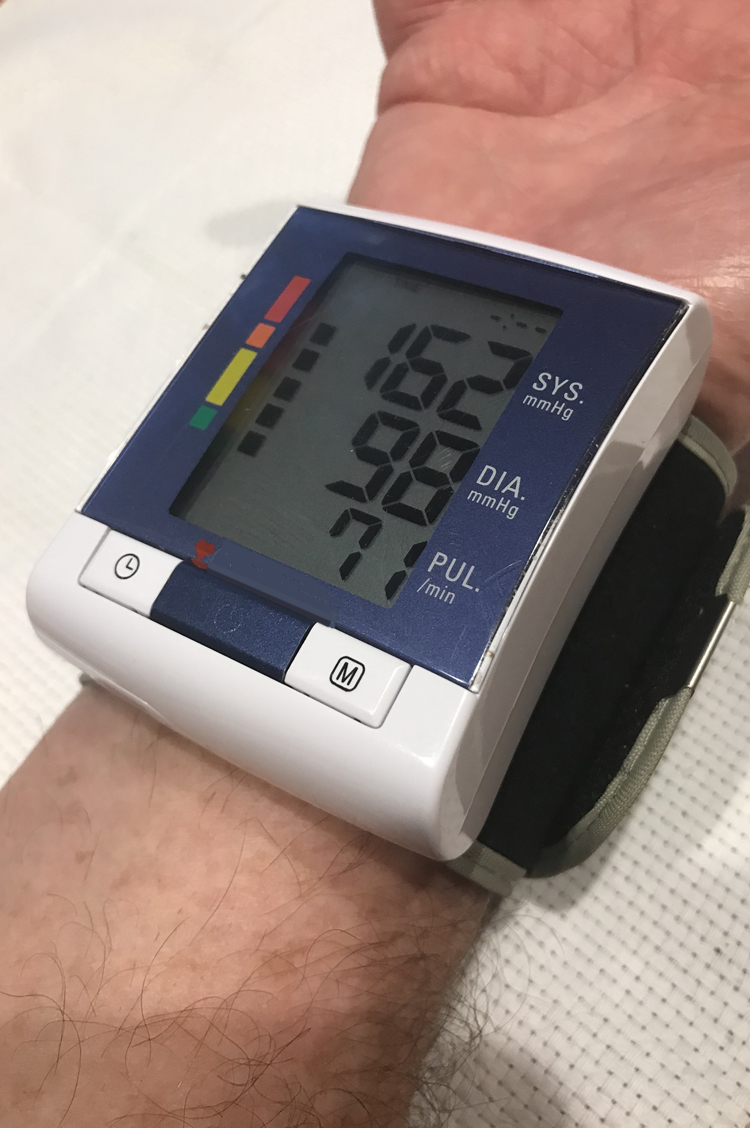 What does it mean when your blood pressure fluctuates?