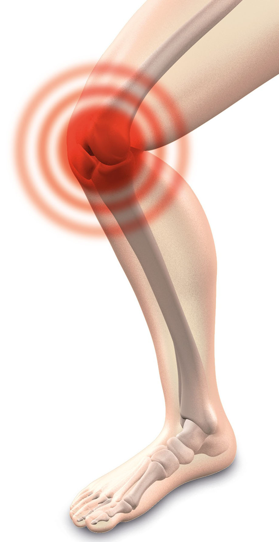 How to reduce arthritis symptoms