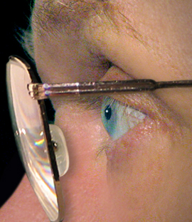 How to treat eye injuries