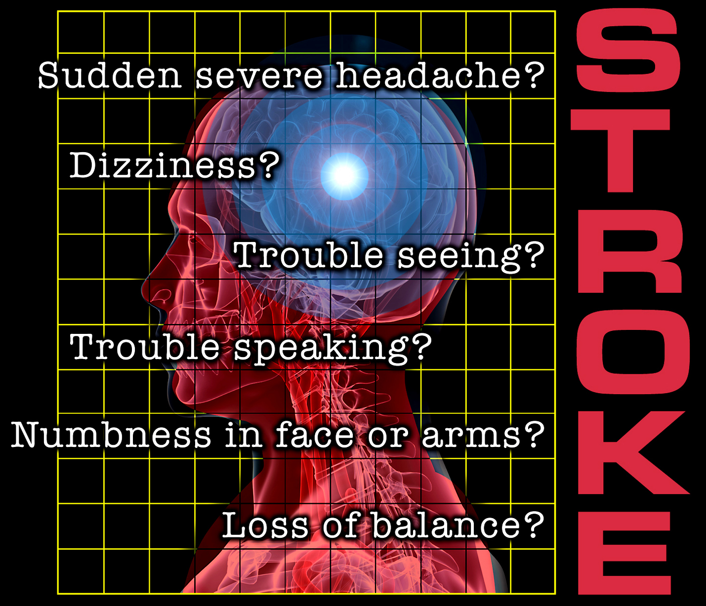 Alcohol influences stroke rate, study finds